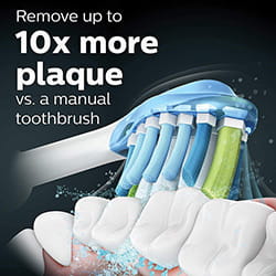 Sonicare S9000 Brushing Benefits